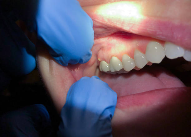 Best Orthodontic Emergency Dentist in Mount Vernon, NY
